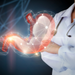 Irritable Bowel Syndrome